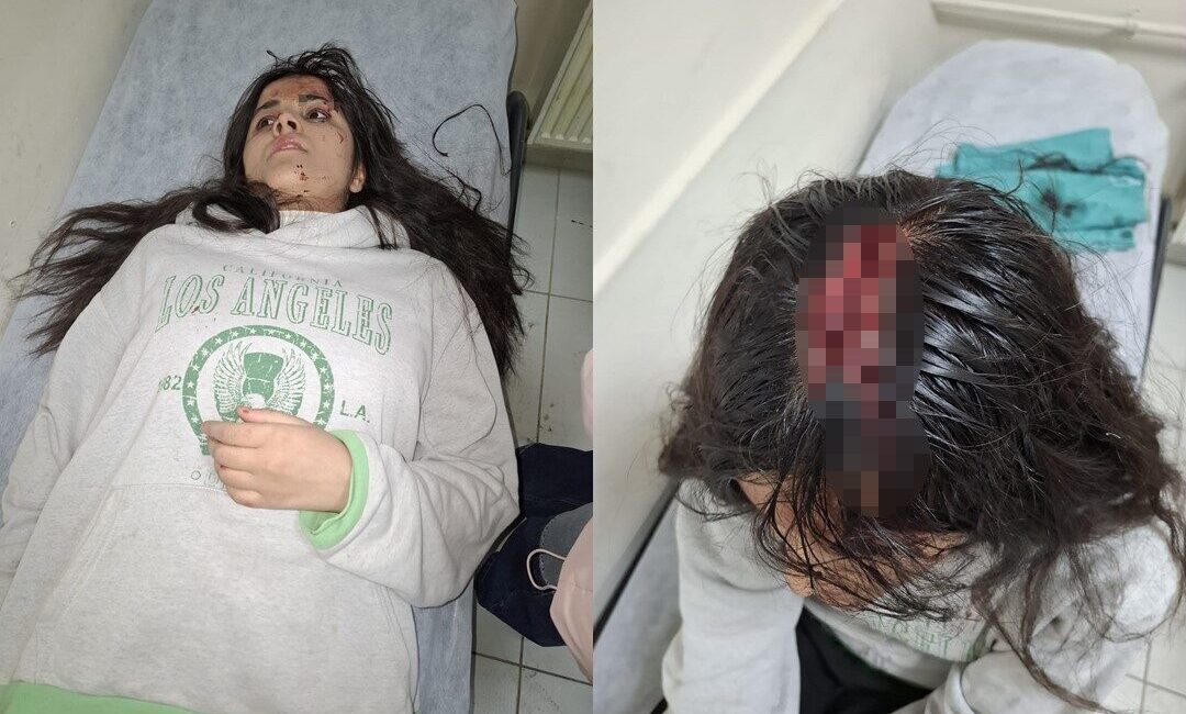 Hakkari’de Buz Kütlesinin Düşmesi Sonucu Genç Kız Yaralandı Hakkari'de 17 yaşındaki Büşra T., 7 katlı bir binanın 4.