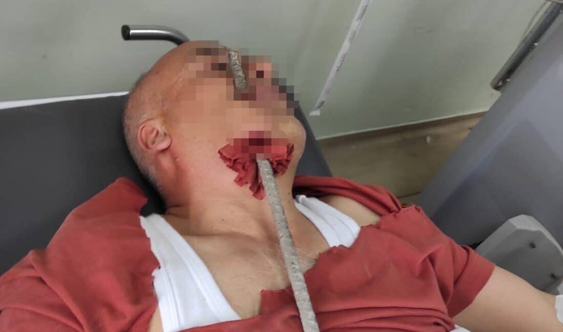 Hatay’da inşaat işçisinin yüzüne saplanan demir, itfaiye tarafından kurtarıldı. Hatay'ın İskenderun ilçesinde inşaatta çalışan bir işçinin yüzüne inşaat demiri