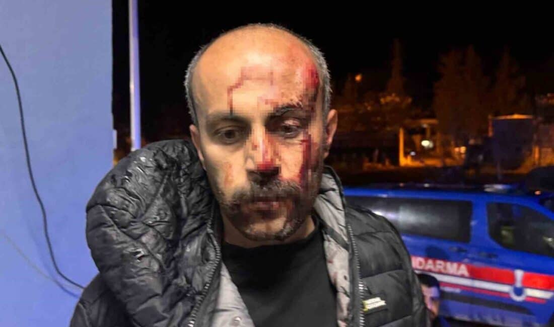 Suruç’ta Avukat, Müvekilinin Yanında Giderken Polis Tarafından Darp Edildi Şanlıurfa'nın Suruç ilçesinde Avukat Yılmaz Birden, müvekilinin gözaltına alındığı esnada
