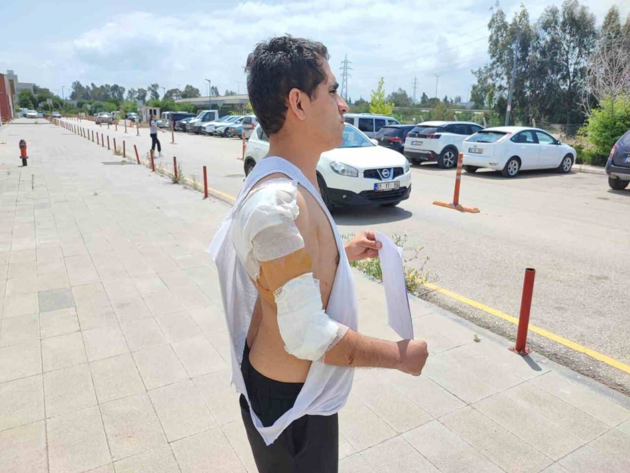 Adana'da kolu kırık olan 24 yaşındaki Mehmet Esentürk, hastaneye gitmek