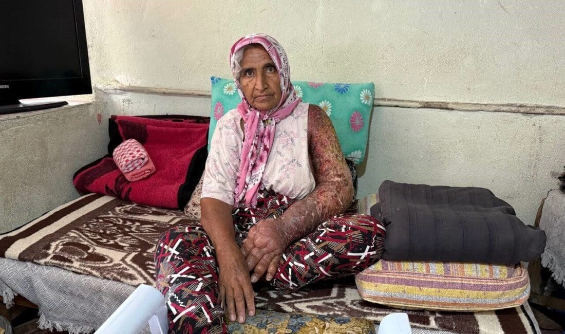 Adana'nın Kozan ilçesinde yaşayan 65 yaşındaki Şadiye Açin, 8 yıldır