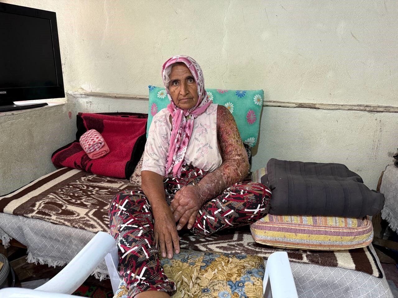 Adana'nın Kozan ilçesinde yaşayan 65 yaşındaki Şadiye Açin, 8 yıldır