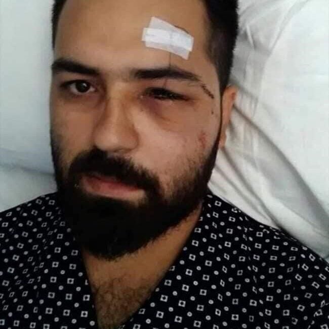 15 Temmuz Gazisi Muhammed Musa Akkoç, darbe girişimine karşı mücadelede