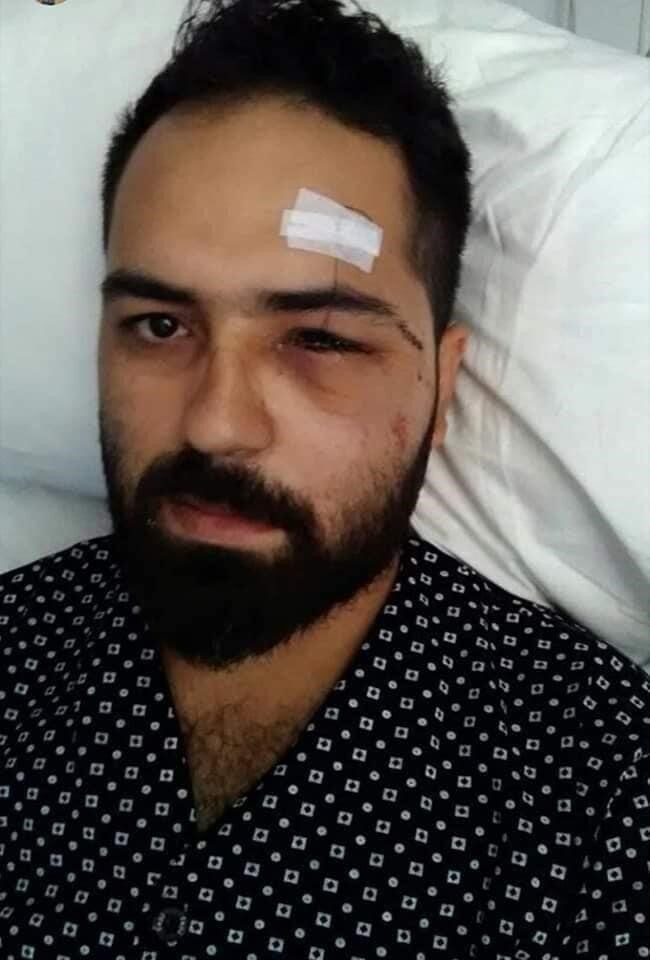 15 Temmuz Gazisi Muhammed Musa Akkoç, darbe girişimine karşı mücadelede