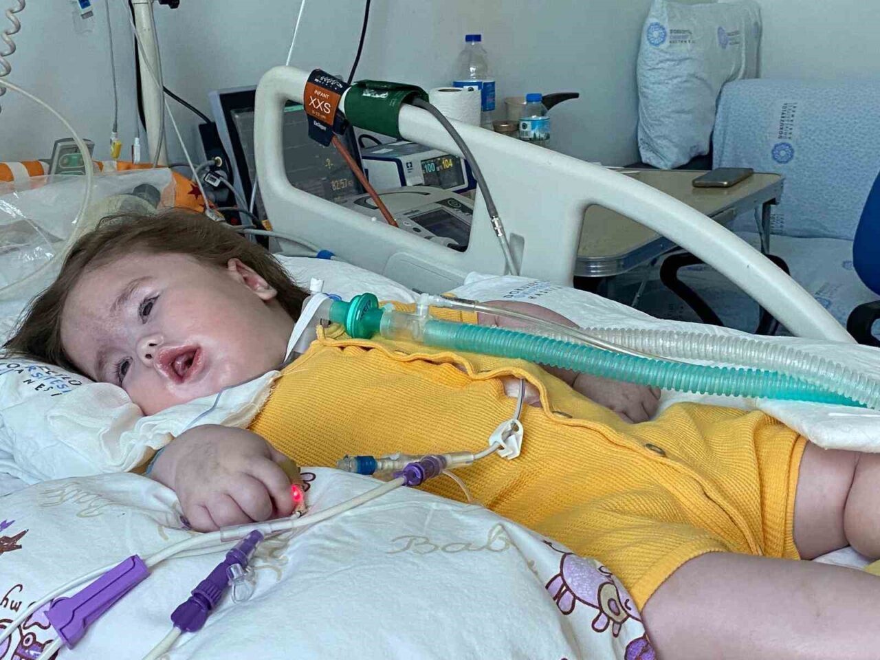 İzmir'de Özel Karataş Hastanesi'nde doğan Vedat Eymen Dağlı, akciğerindeki sıvı