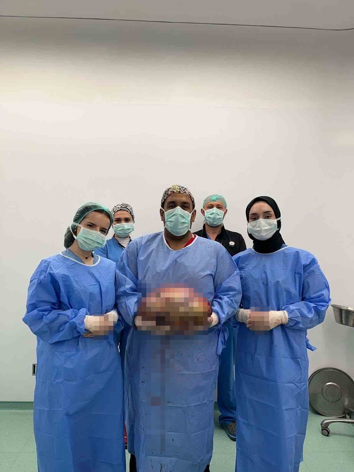 Bursa'da karın bölgesinde 10 kilogramlık kitle bulunan 40'lı yaşlardaki kadın,