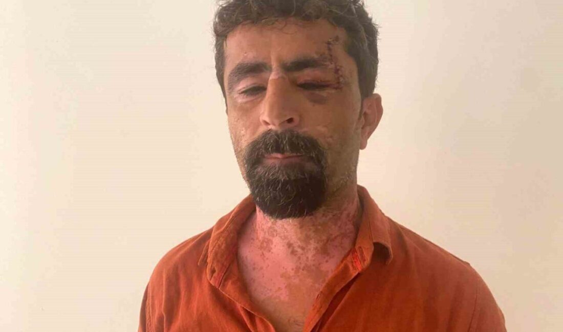 Antalya'da damat H.A., eşi R.S.A.'nın babaevine döndükten sonra kayınpederi Hasan