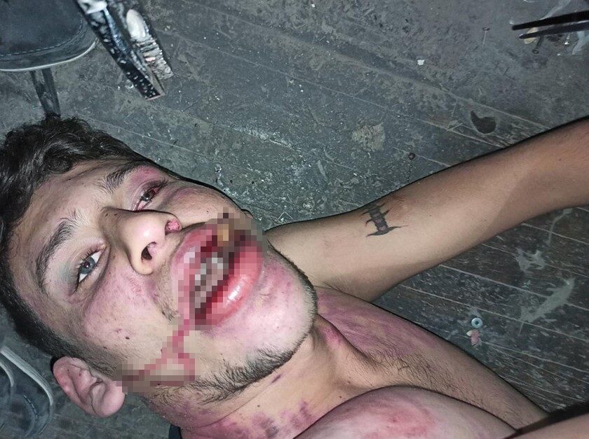 Antalya'da iş yerinde 3 gün boyunca işkenceye maruz kalan 23