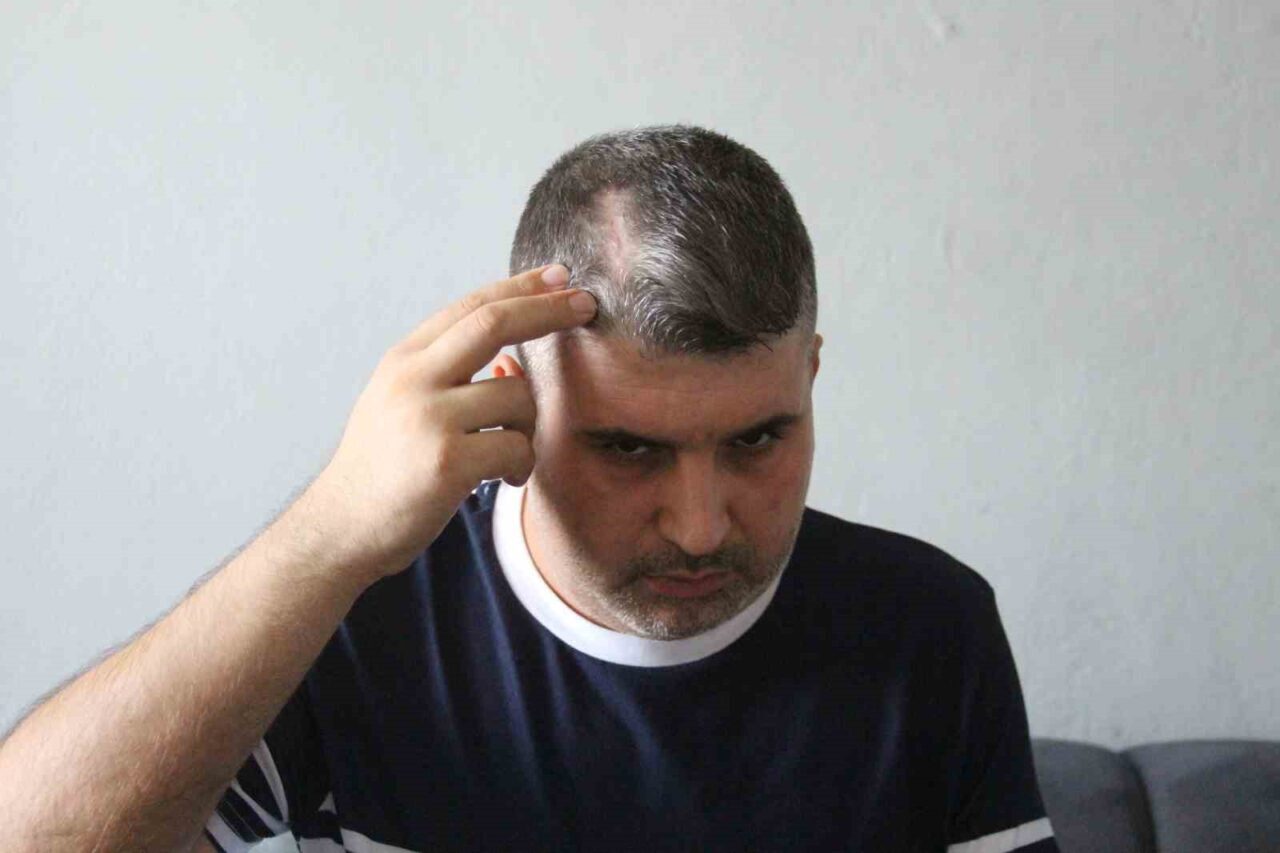 Adana'da beyzbol sopalı saldırıya uğrayan Mehmet Alpaltun, dayısı M.A.'nın tutuksuz