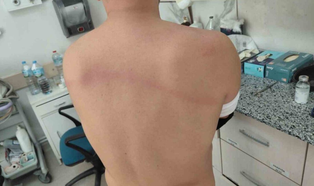 Kale Belediye Başkanı Erkan Hayla Hakkında Zabıta Memurlarına Silahlı Yaralama İddiasıyla Soruşturma Başlatıldı Denizli'de CHP’li Kale Belediye Başkanı Erkan Hayla'nın zabıta memurlarına sopayla