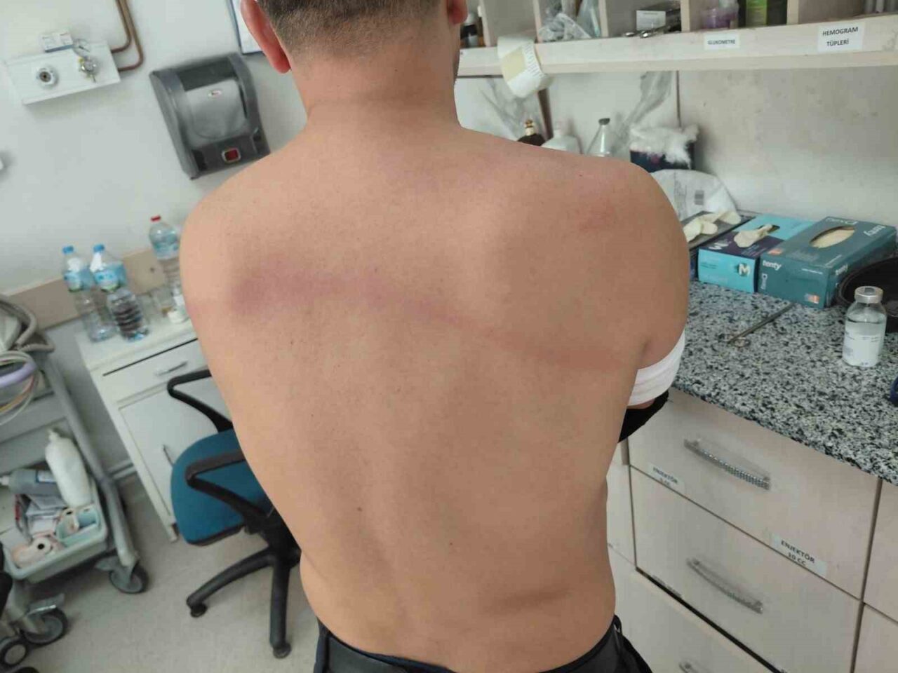 Denizli'de CHP’li Kale Belediye Başkanı Erkan Hayla'nın zabıta memurlarına sopayla