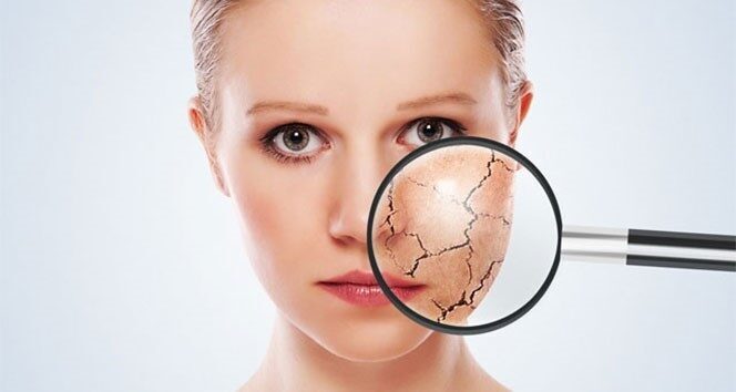 Medicana Bursa Hastanesi'nden Dermatoloji Uzmanı Dr. Gülbiye Güler, kış aylarında