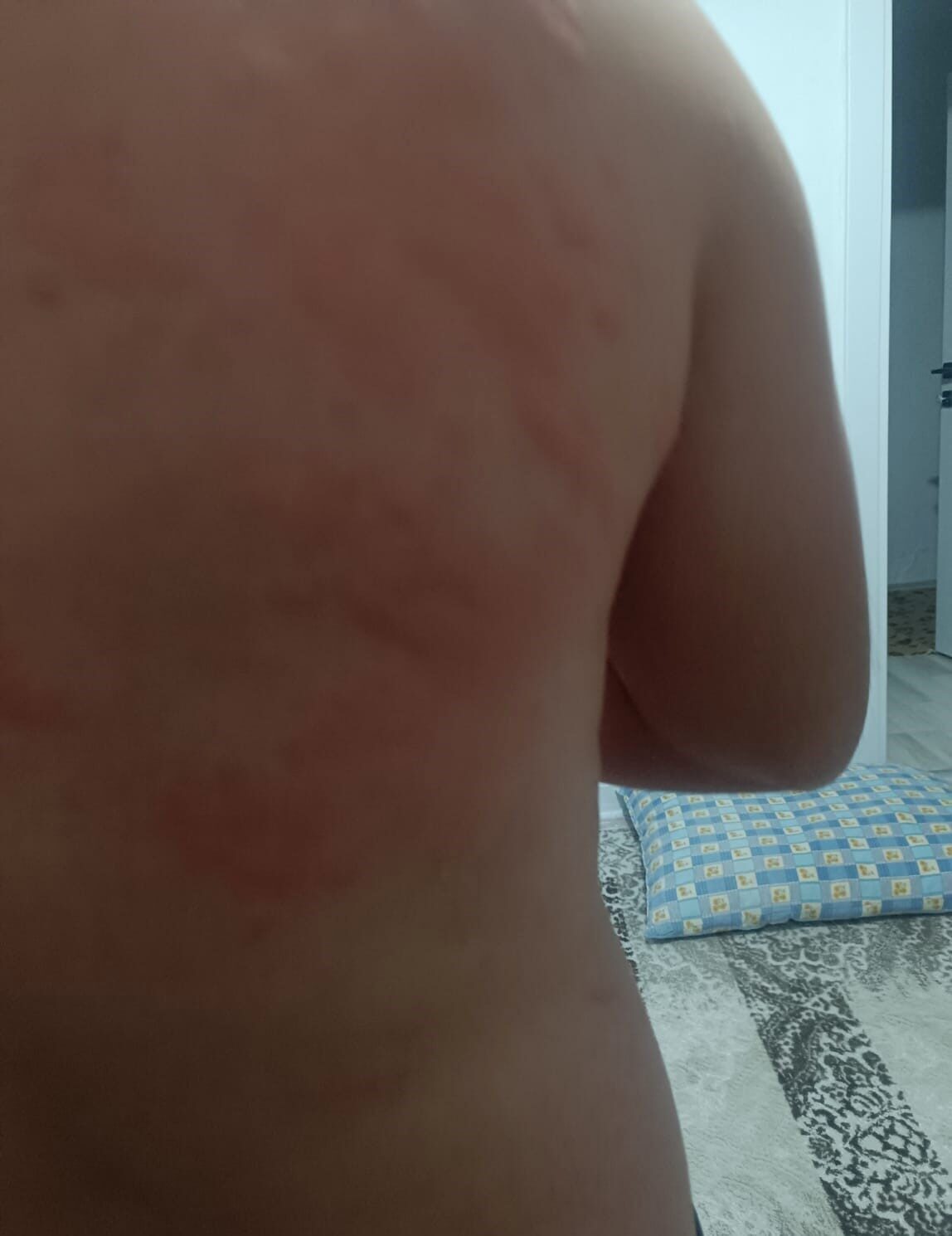 Karakoçan’da İş Yerinde Böcek Sokması Sonucu Hastaneye Başvuran Şahıs Tedavi Altına Alındı