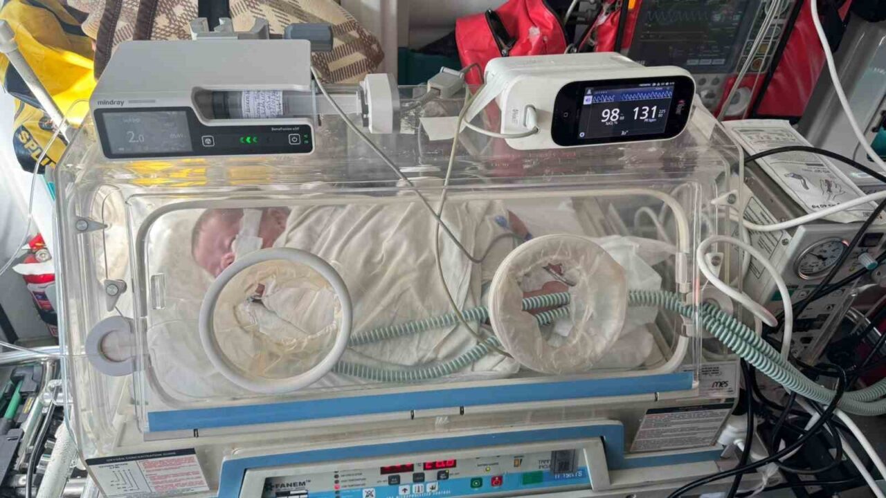Ankara Bilkent Şehir Hastanesi'nde 170 gündür tedavi gören Kerem bebek,