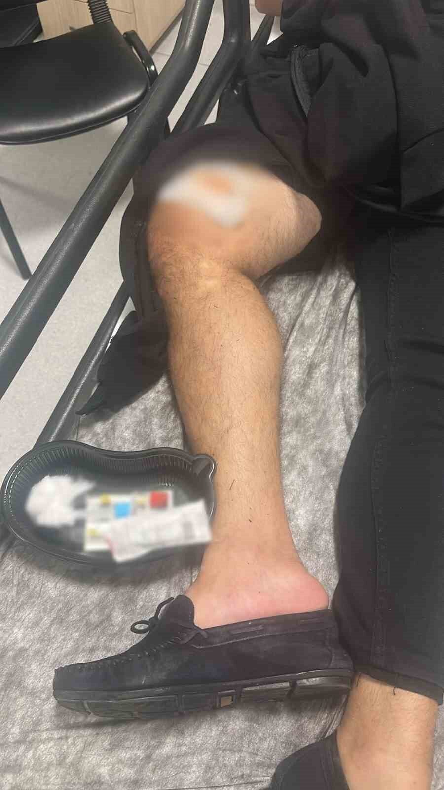 Marmaris'te M.A. ve E.A. arasında alacak meselesi nedeniyle çıkan kavgada