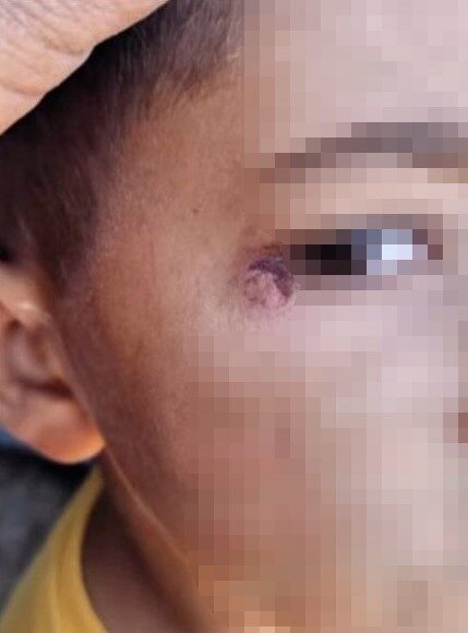 Harran’da Temizlik Görevlisi, Öğrenciyi Darp Edip Yüzünde Sigara Söndürerek Tutuklandı