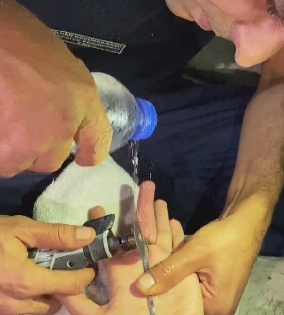 Hatay'ın Kırıkhan ilçesinde bir vatandaş parmağına takılan yüzüğü çıkartmakta zorluk
