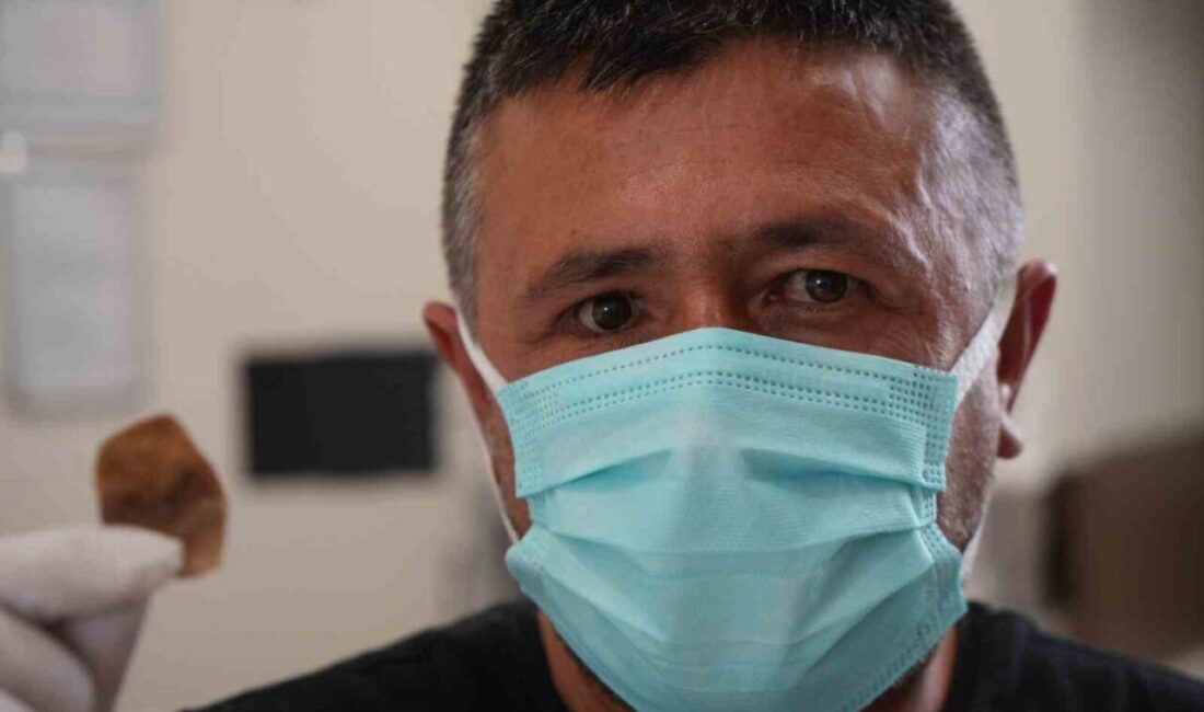44 yaşındaki Ömer Çoban, iş kazası sonrası takılan protez gözündeki