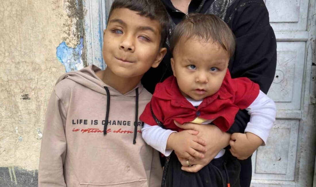 Eskişehirli Kardeşlerin Göz Sağlığına Kavuşması, Hayırsever Desteğiyle Yeni Umutlar Yarattı Eskişehir'de başarılı bir ameliyatla görme yetisini kazanan kardeşler Hamit ve