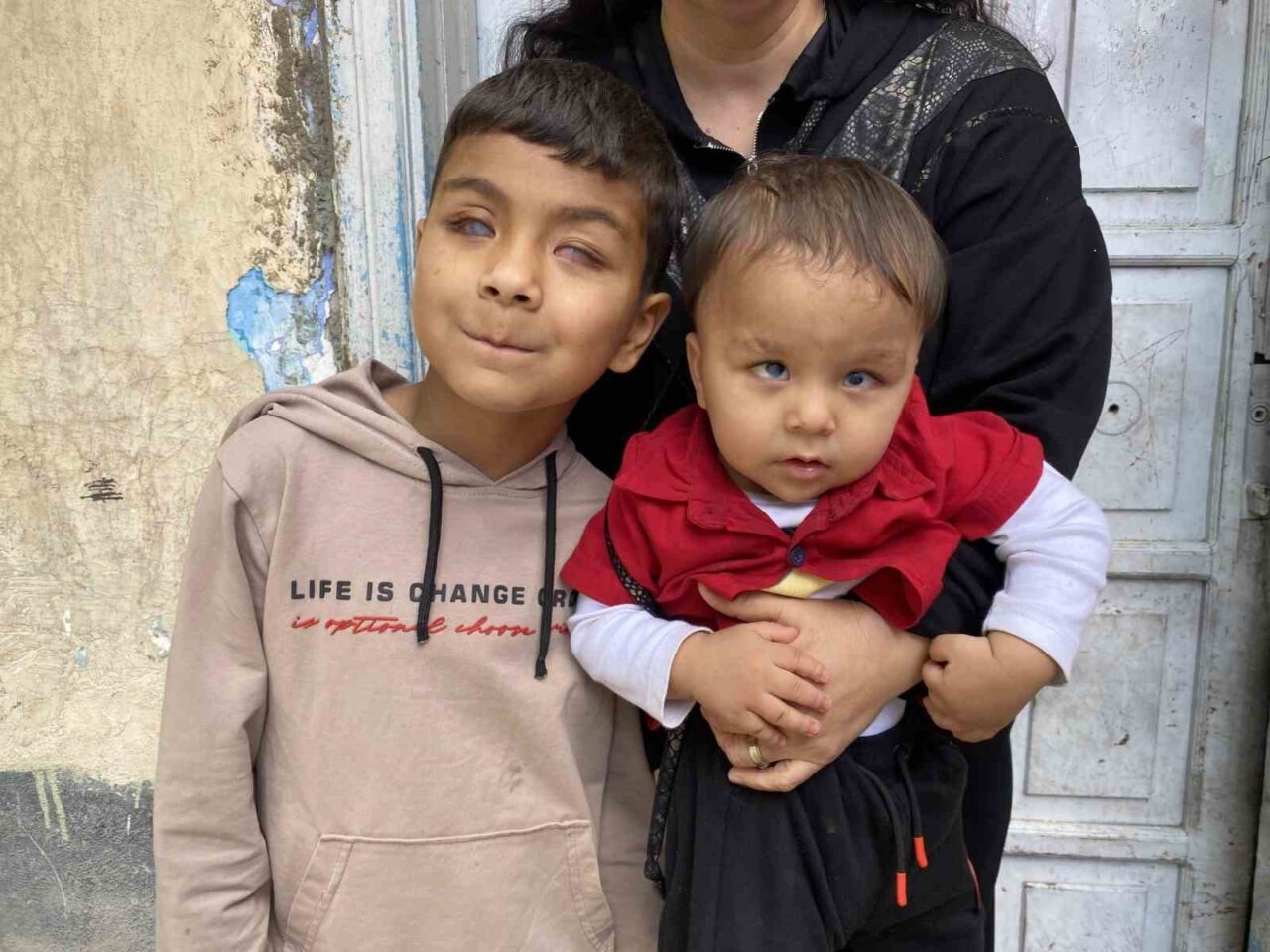 Eskişehir'de başarılı bir ameliyatla görme yetisini kazanan kardeşler Hamit ve