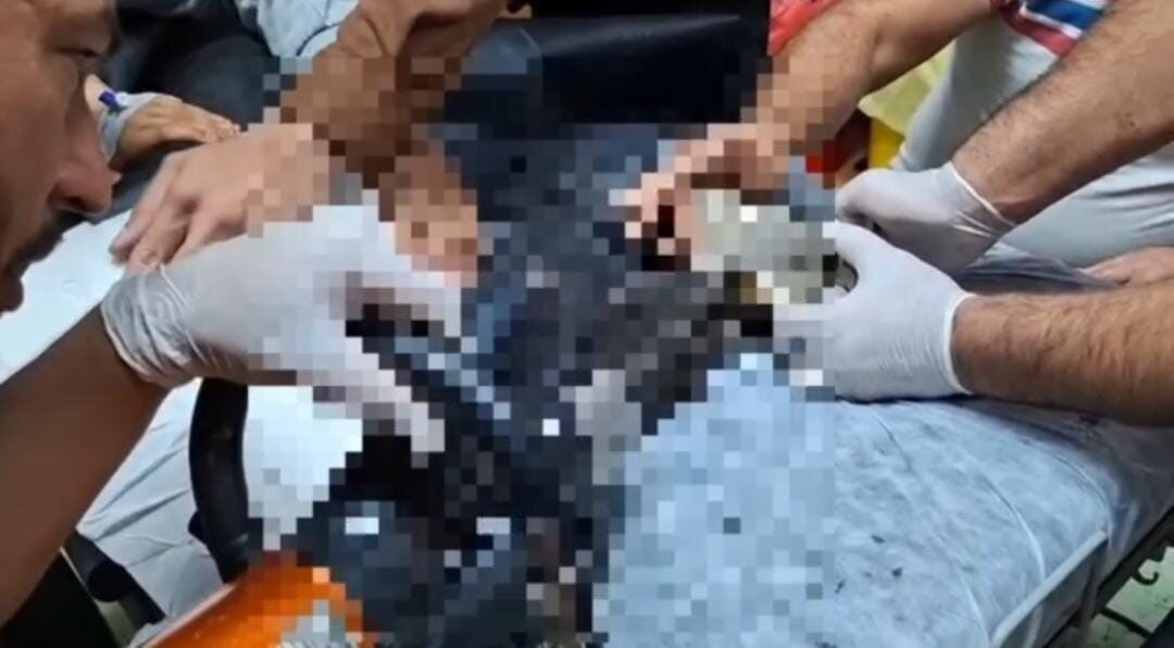 Suriye’nin Tel Abyad bölgesinde elini kıyma makinesine kaptıran 8 yaşındaki