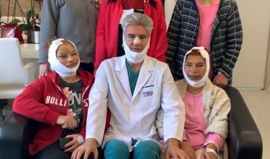 Prof. Dr. Hayati Akbaş, Samsun'daki FBM Tıp Merkezi'nde yüz germe