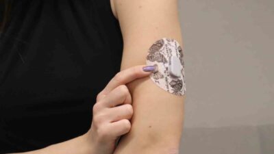 Acıbadem Üniversitesi Diyabet Araştırma Merkezi, yapay pankreas teknolojisini tanıtan bir