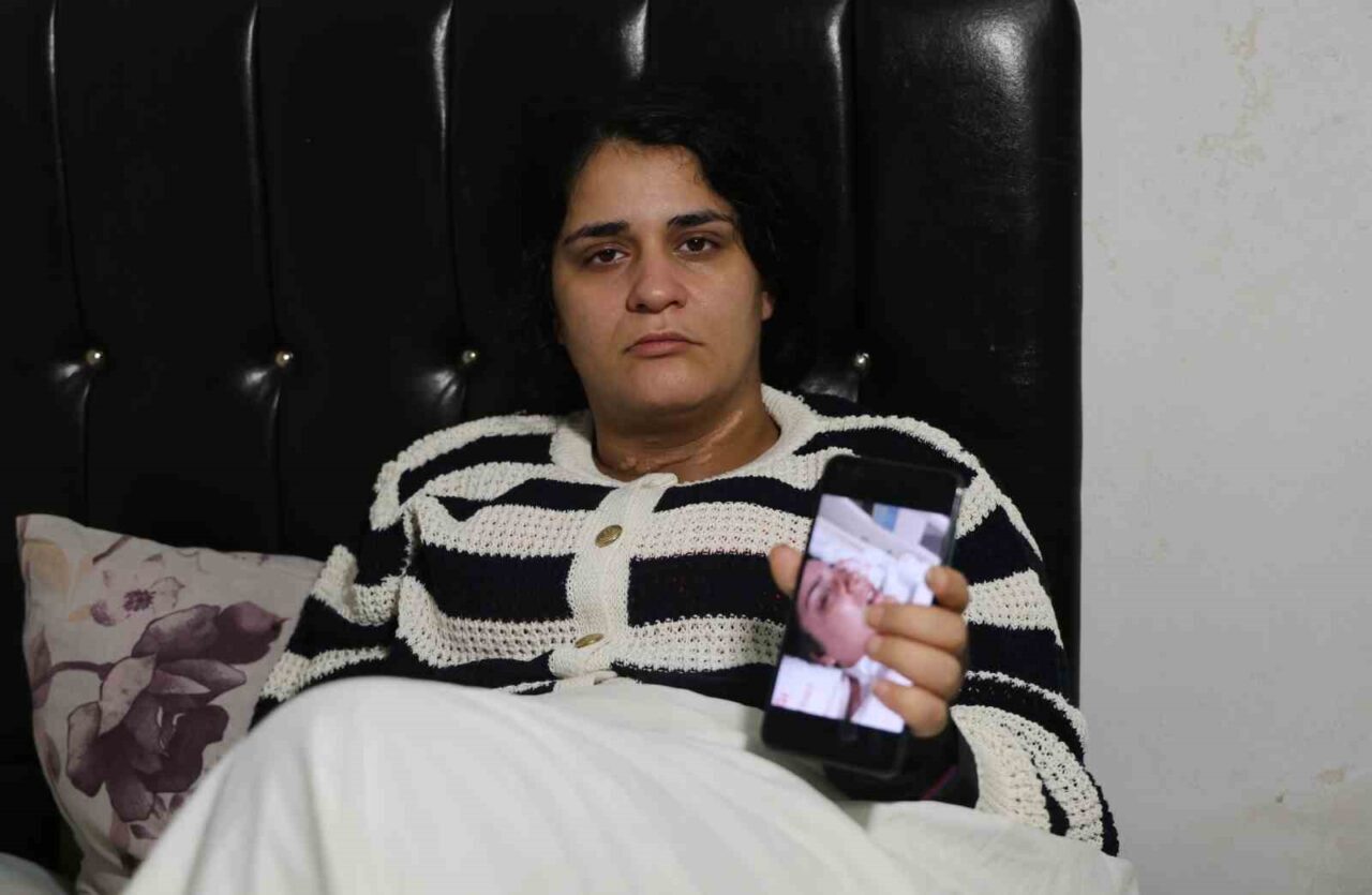 Adana’da Eşinden Şiddet Gören Anne, Zorlu Tedavi Sürecinin Ardından Sağlığına Kavuşmayı Bekliyor