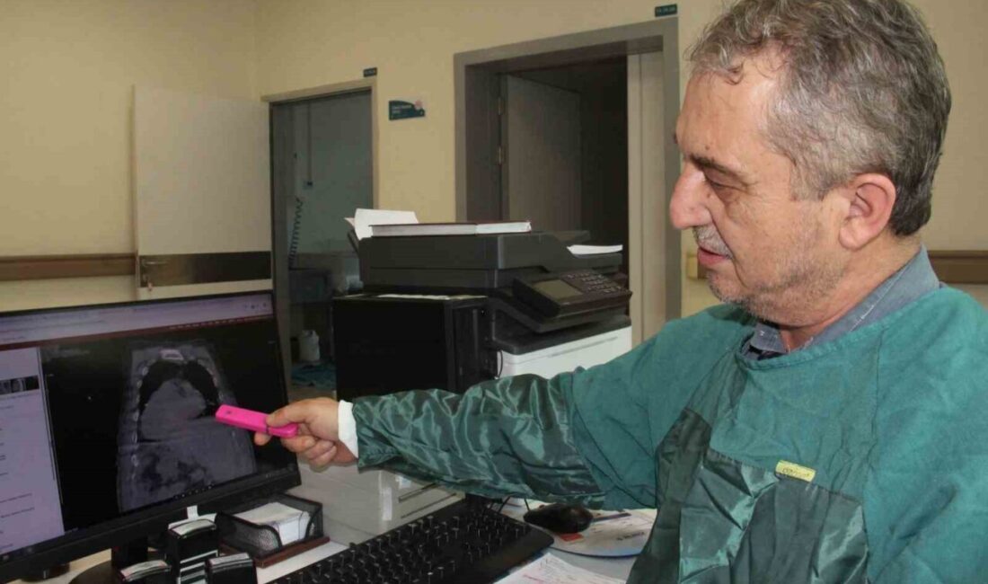 “Demans Hastaları İçin Yeni Beslenme Yaklaşımı Giresun’da Geliştirildi” Giresun Eğitim ve Araştırma Hastanesi, demans hastalarına yönelik "Karadeniz PEG