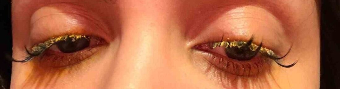 İstanbul Esenyurt'ta Dilara Çalışkan, güzellik salonunda kirpik yaptırırken hatalı işlem