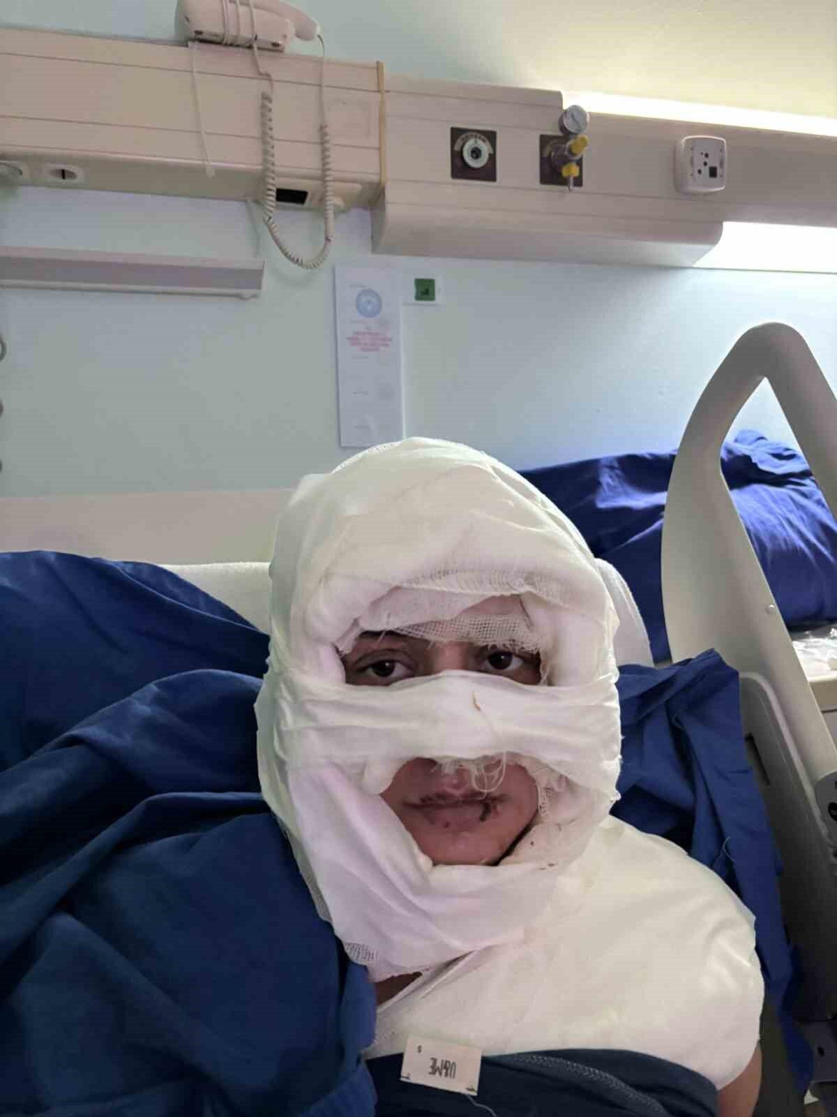 İstanbul Kadıköy'de Gözde Yılmaz, S.G.A. adlı bir kadın tarafından yanıcı