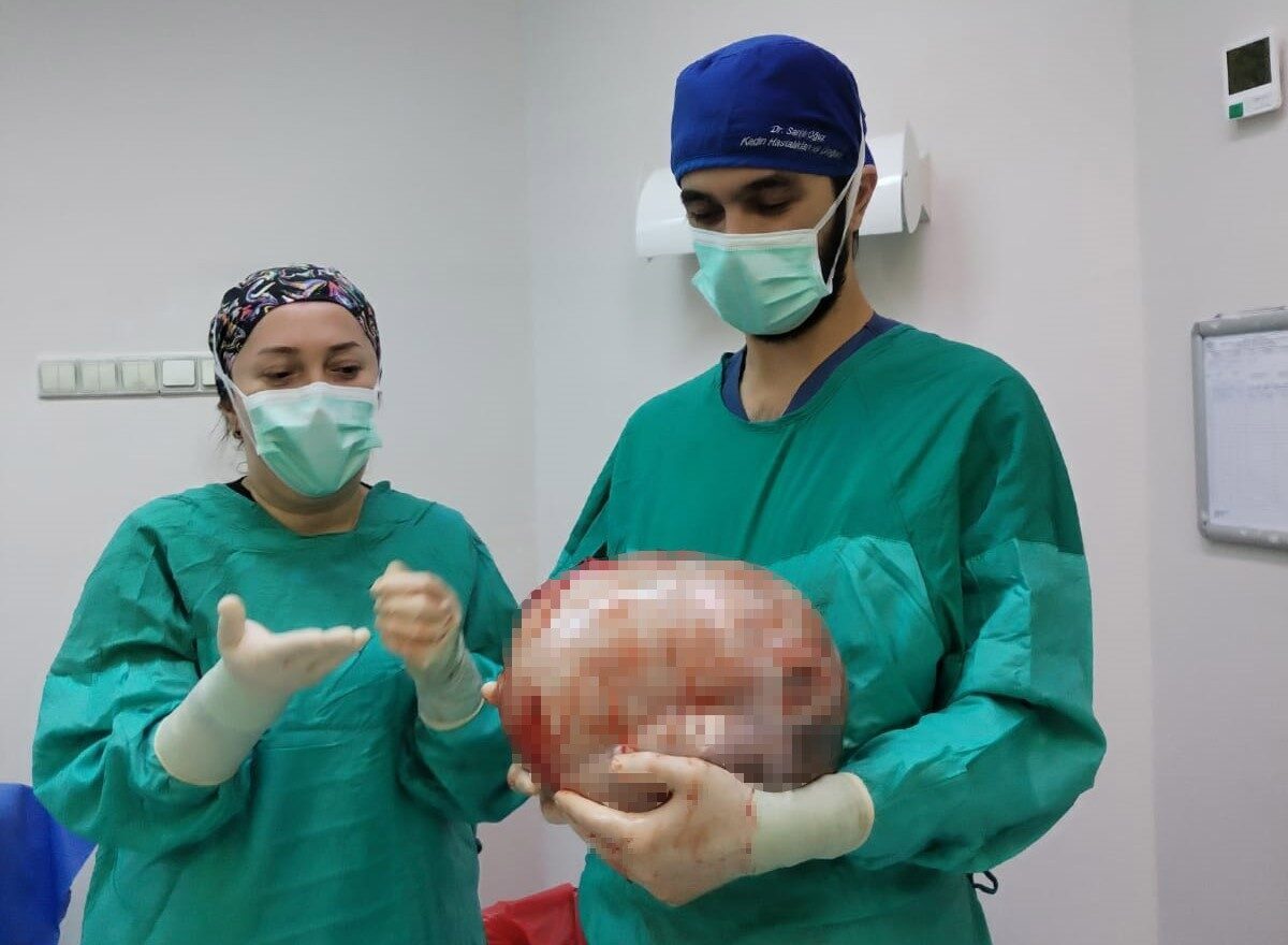 Amasya'da Şule Akgül, midesinin 2 ayda 9 aylık hamile gibi