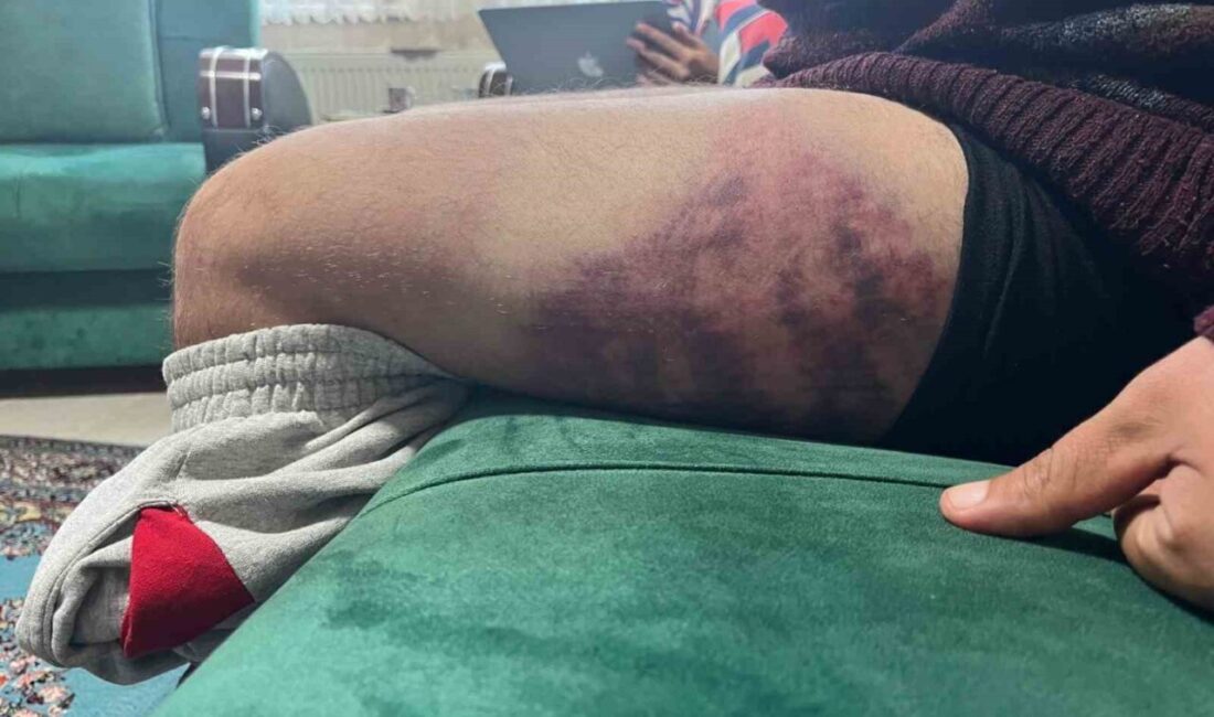 İzmit’te Yüzde 85 Otizmli Şahsa Fırın İşletmecisi Tarafından Gerçekleştirilen Şiddet Olayı Tepkilere Neden Oldu Kocaeli'nin İzmit ilçesinde, yüzde 85 otizmli ve epilepsi hastası Ertuğrul