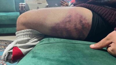 Kocaeli'nin İzmit ilçesinde, yüzde 85 otizmli ve epilepsi hastası Ertuğrul