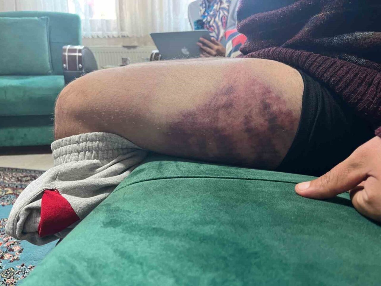 İzmit’te Yüzde 85 Otizmli Şahsa Fırın İşletmecisi Tarafından Gerçekleştirilen Şiddet Olayı Tepkilere Neden Oldu