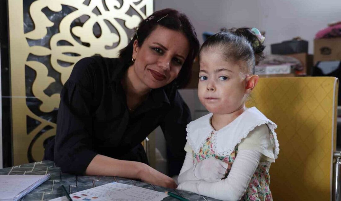 Elazığ'da evde eğitim veren öğretmen Arzu Binay, epidermolizis bülloza hastası