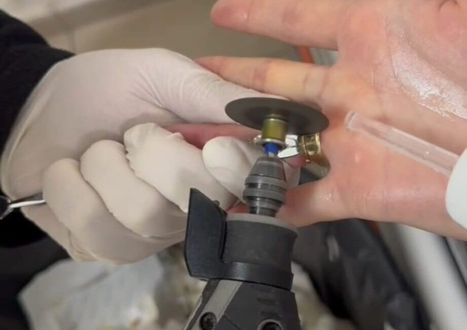 Batman’da Kadının Parmağına Sıkışan İki Yüzük, İtfaiye Ekiplerince Güvenle Çıkartıldı Batman'da parmağına sıkışan iki yüzüğü çıkaramayan bir kadın, hastaneye başvurdu.