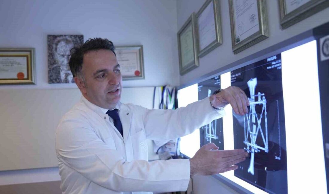 Prof. Dr. Adnan Kara, Medipol Mega Üniversite Hastanesi'nde kemik deformiteleri