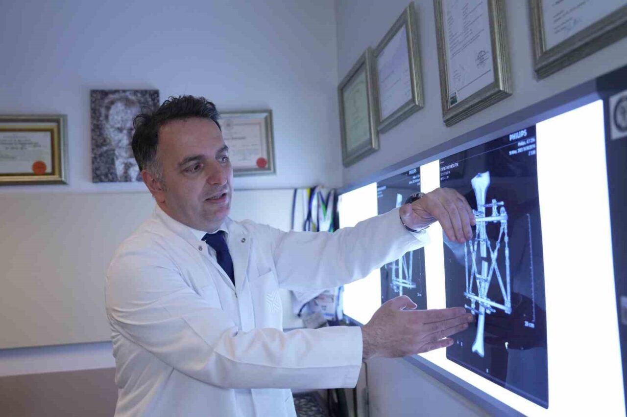 Prof. Dr. Adnan Kara, Medipol Mega Üniversite Hastanesi'nde kemik deformiteleri