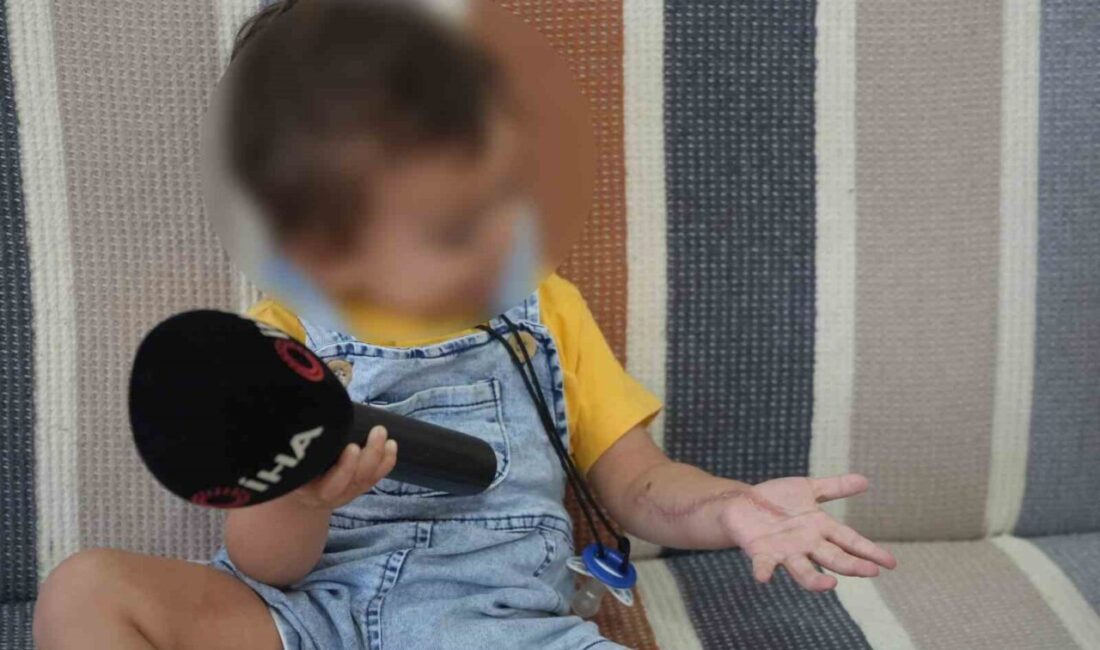 Iğdır’da tomografi sırasında çocukta meydana gelen kol şişmesi sonrası aile dava açtı Iğdır'da 1,5 yaşındaki Osman Poyraz Meşe, ilaçlı tomografi sırasında kolunda