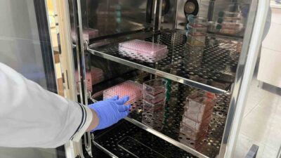 Alanya Alaaddin Keykubat Üniversitesi Tıp Fakültesi'nde, Parkinson hastalığının bağırsak ve