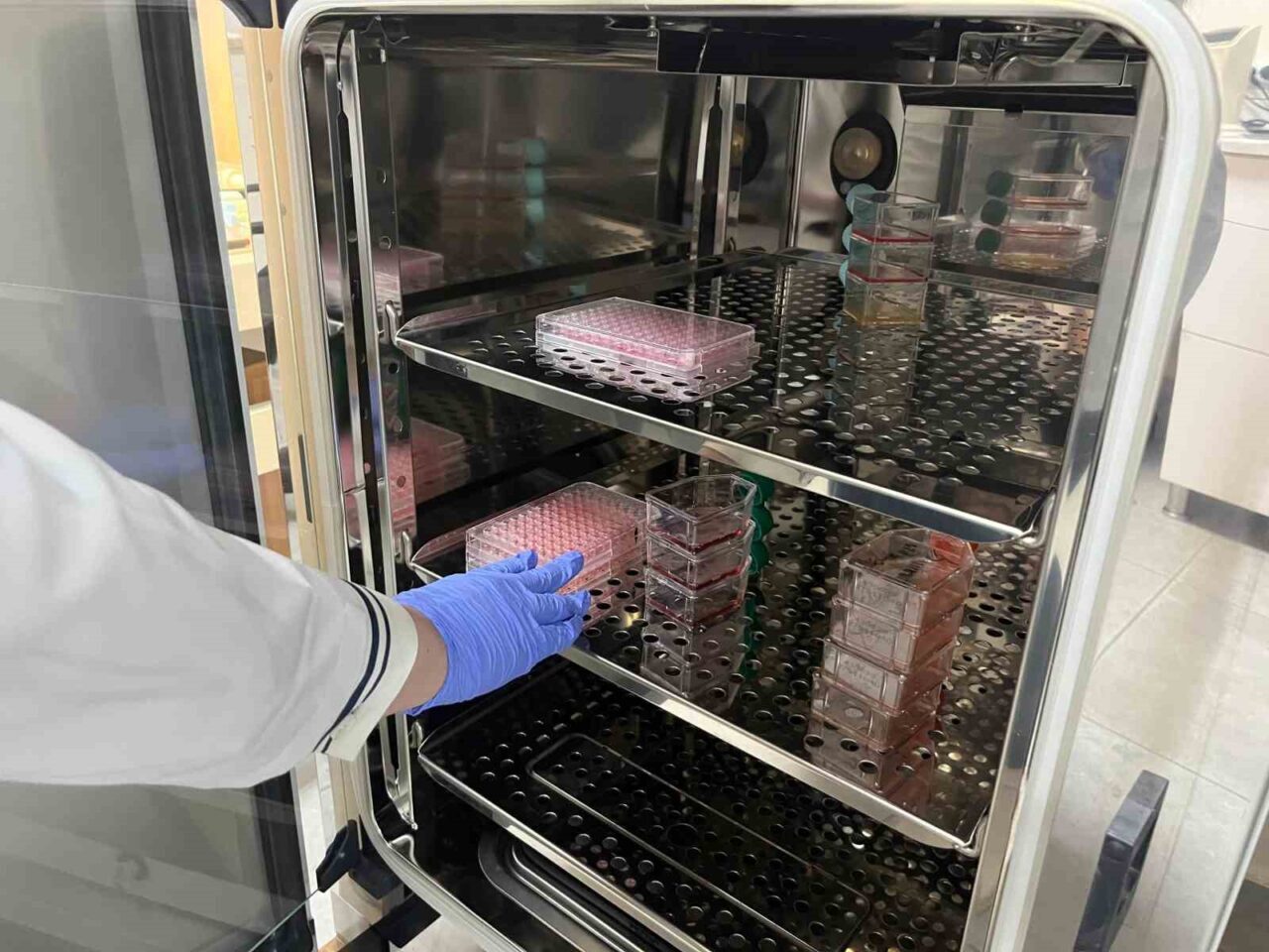 Alanya Alaaddin Keykubat Üniversitesi Tıp Fakültesi'nde, Parkinson hastalığının bağırsak ve