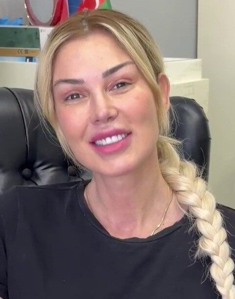 Petek Dinççöz, Prof. Dr. Hayati Akbaş'ın gerçekleştirdiği yüz gençleştirme operasyonunun