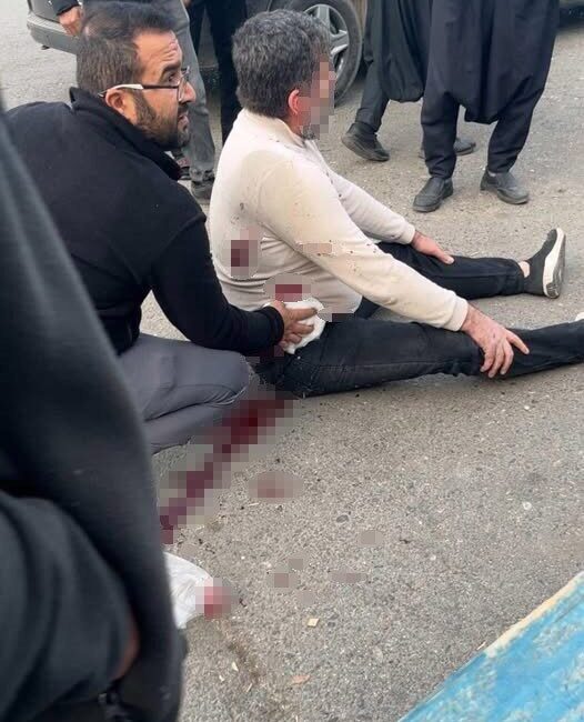 Şanlıurfa'nın Haliliye ilçesinde yaşanan bıçaklı kavgada, iki kişi arasında çıkan