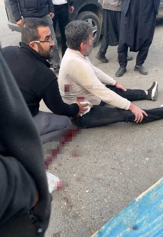 Şanlıurfa'nın Haliliye ilçesinde yaşanan bıçaklı kavgada, iki kişi arasında çıkan