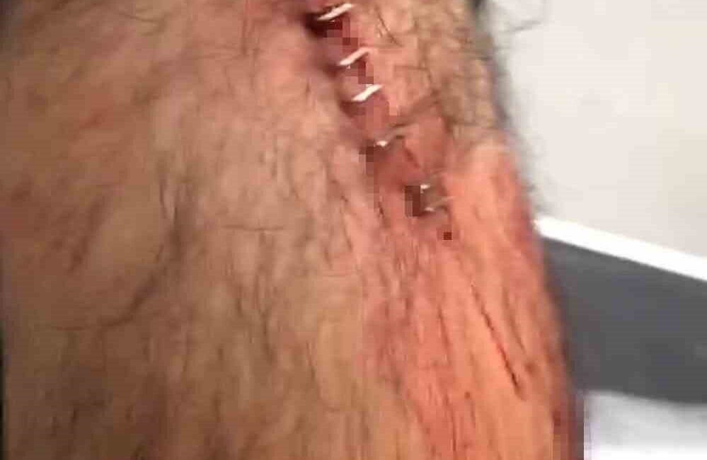 Şanlıurfa’da Öğretmene Park Halinde Jiletli Saldırı! Şanlıurfa'nın Karaköprü ilçesinde, öğretmen Ömer B. aracını park ederken kendisinden