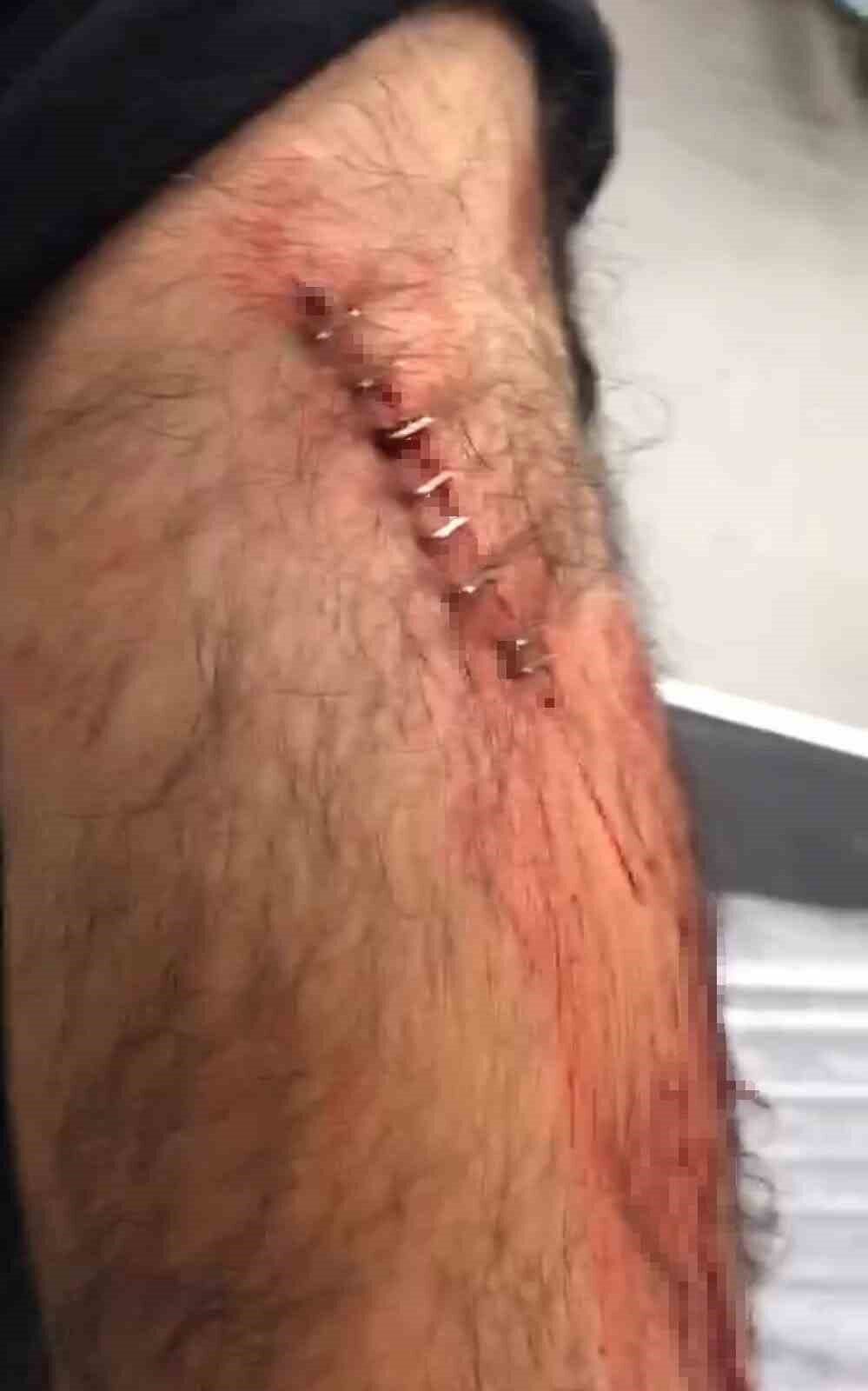 Şanlıurfa'nın Karaköprü ilçesinde, öğretmen Ömer B. aracını park ederken kendisinden