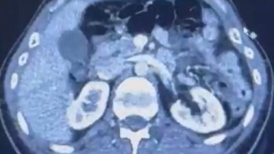 Kayseri İl Emniyet Müdürlüğü, İran'dan uyuşturucu getirirken yakalanan S.C., R.B.C.