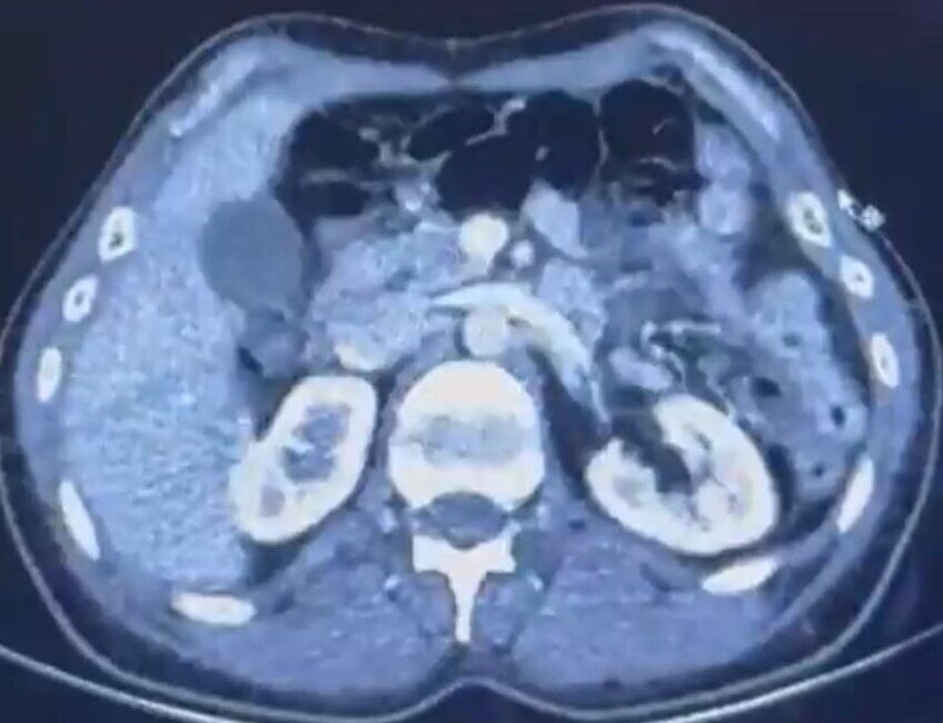 Kayseri’de İran’dan Uyuşturucu Getiren Şüphelilere Operasyon: 554 Gram Madde Ele Geçirildi Kayseri İl Emniyet Müdürlüğü, İran'dan Türkiye'ye uyuşturucu madde getiren S.C.,