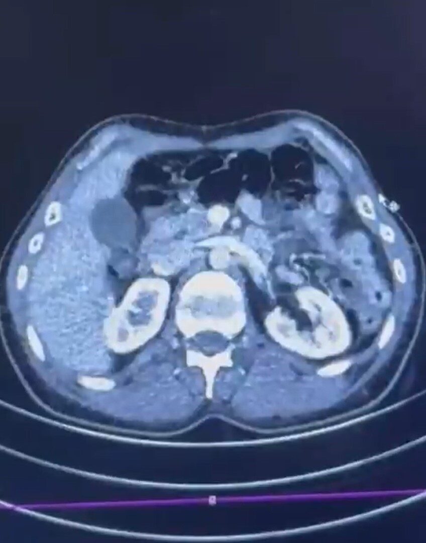 Kayseri İl Emniyet Müdürlüğü, İran'dan uyuşturucu getirirken yakalanan S.C., R.B.C.